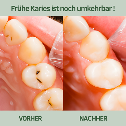 Baumkau - Zahnpasta Tabs