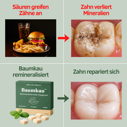 Baumkau™ - Remineralisierender Kaugummi